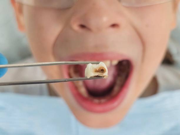 Best Emergency Broken Tooth Repair in Sallisaw, OK