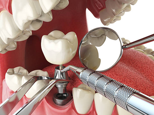 Best Emergency Tooth Extraction in Sallisaw, OK
