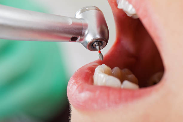 Best Emergency Tooth Extraction in Sallisaw, OK